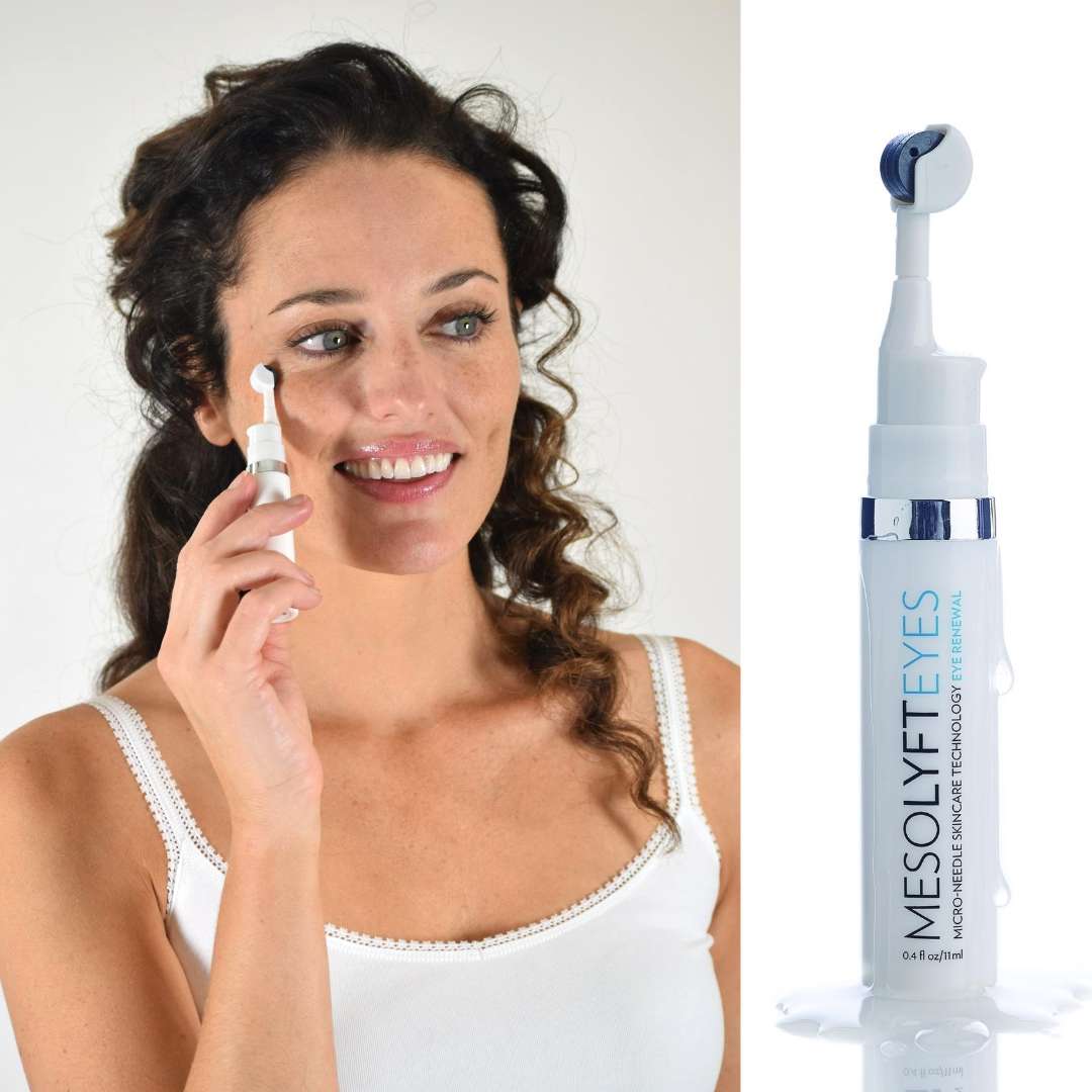 eye-wrinkles-non-surgical-eye-lift-mesolyft-mesolyft