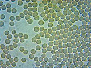 After Vasindux Pro Microscope After Vasindux Pro Microscope