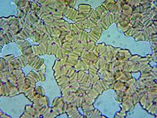 Before Vasindux Pro Microscope Before Vasindux Pro Microscope