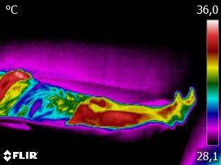 Circulation Before PEMF Circulation Before PEMF