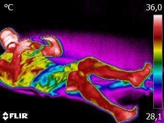 Circulation After PEMF Circulation After PEMF