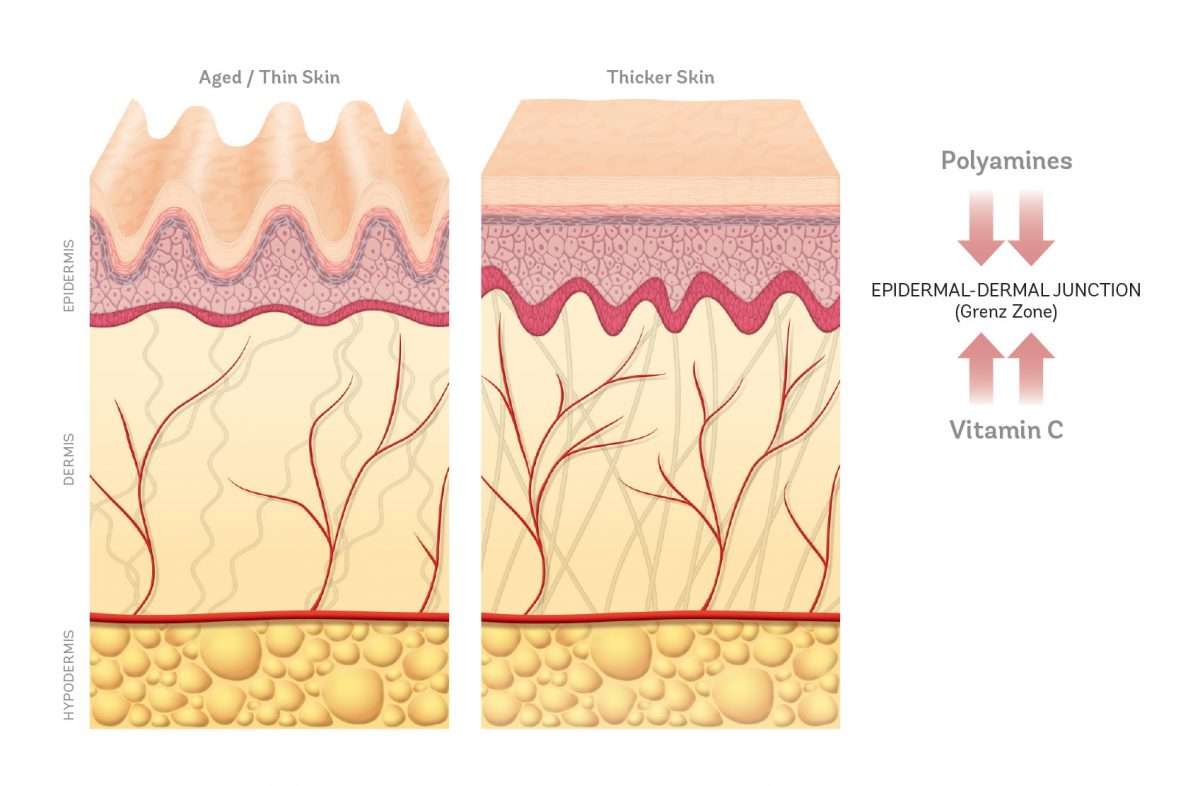 what-is-thin-skin-vivier-pharma