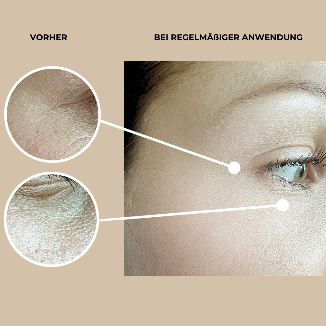 Bidalli Wrinle Care Intense Eye Cream Vorher / Nachher