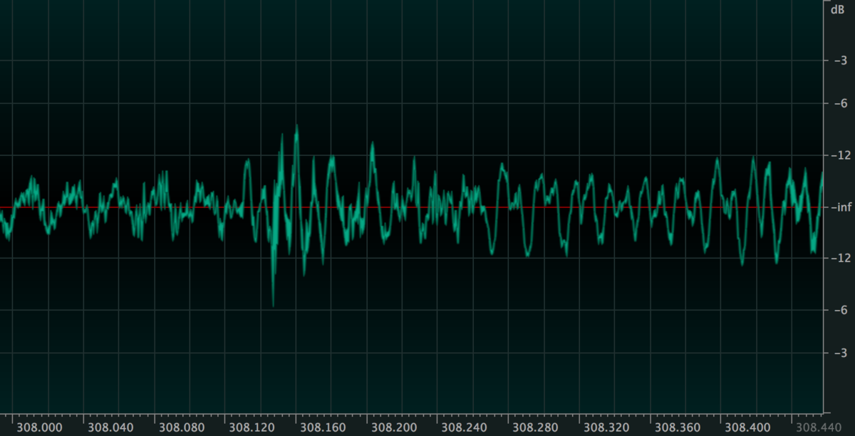 music waveform