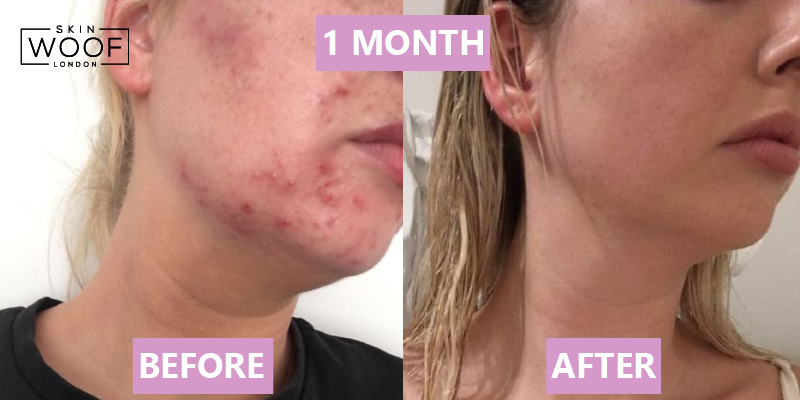 skin woof before and after