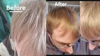 RevivHair REV Advanced grey hair reverse - NEW